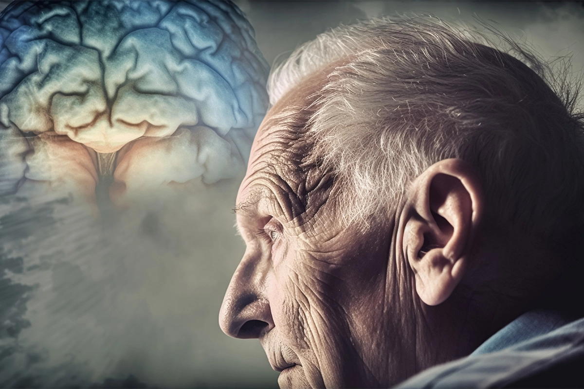 Alzheimer’s disease Causes