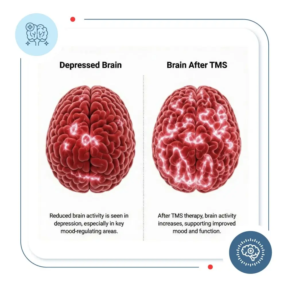 how-does-tms-work