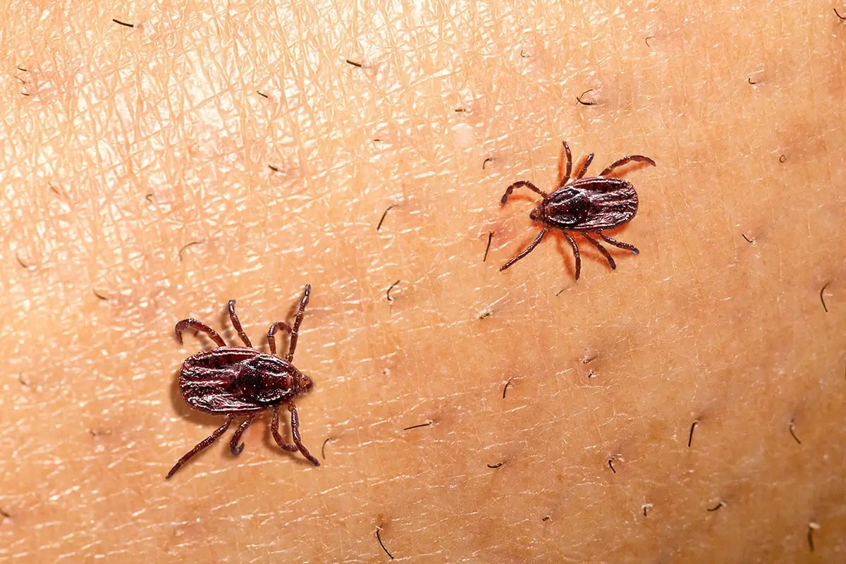parasites-coming-out-of-skin-and-somatic-delusion-patterns